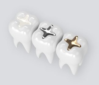 Signs You Might Need a Dental Filling: When to See Your Dentist